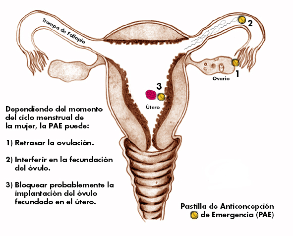 ls-utero